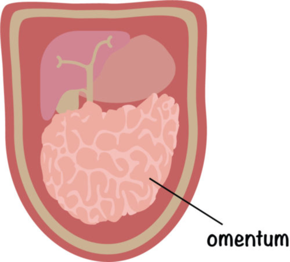 What is an Omentectomy? MyMediTravel Knowledge