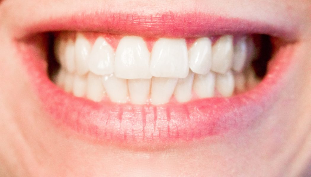 What is so good about Invisalign?