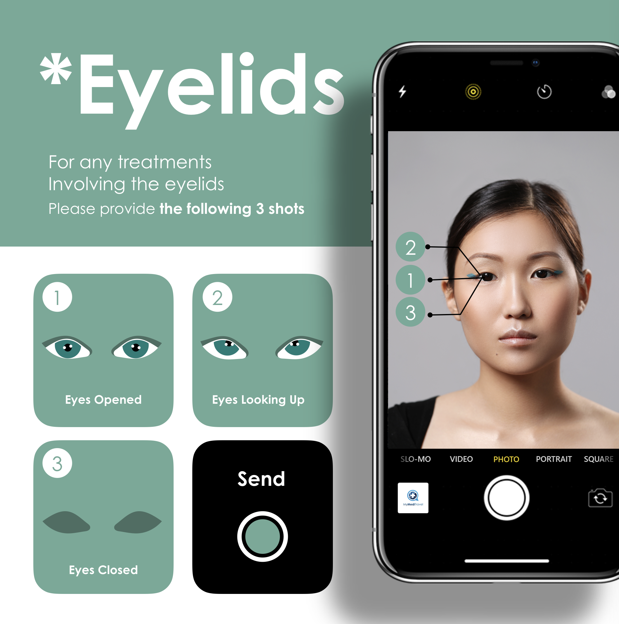 Eyelids Treatments Photo Guide