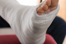 Ankle Surgery Procedure Description