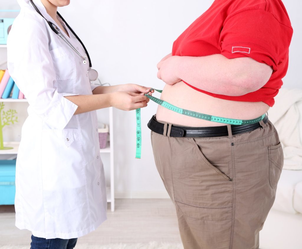 Gastric Bypass Procedure Description