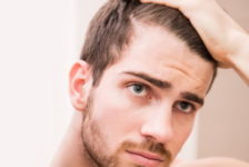 Top 3 Ways to Say Goodbye to Hair Loss Problems in Bangkok