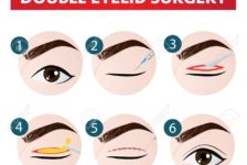 2020 Top Reasons Why You Would Have Double Eyelid Surgery in Thailand