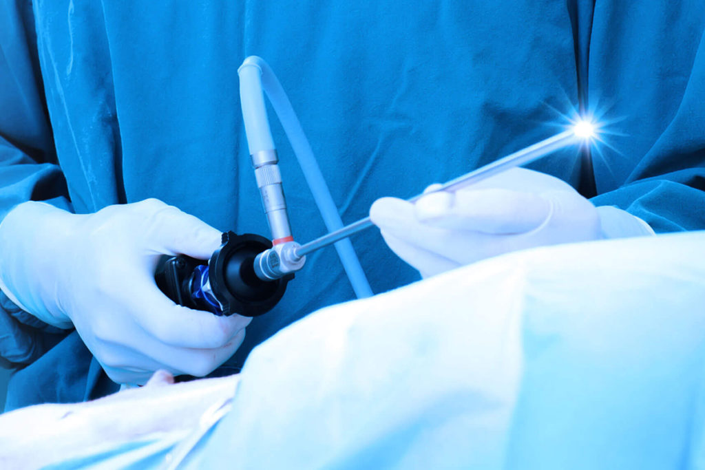 Diagnostic Laparoscopy Procedure Description