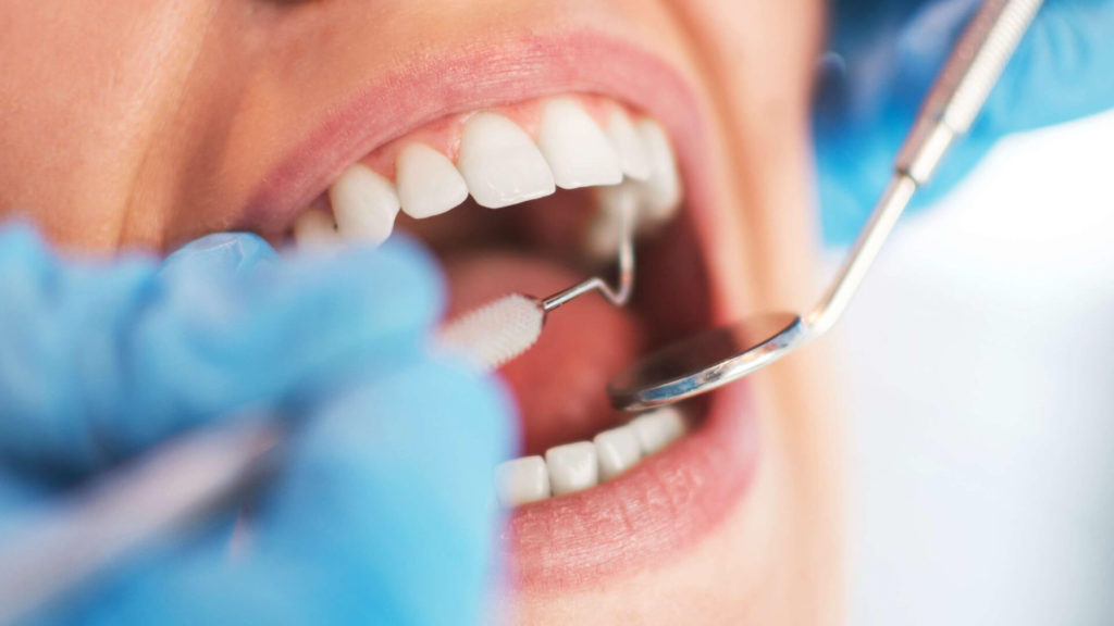 Root Canal Procedure Description