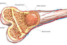 Bone Marrow Transplant Procedure Description