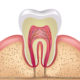 Top Tips on Having a Root Canal in Thailand