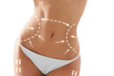 10 Risks and Benefits of Liposuction