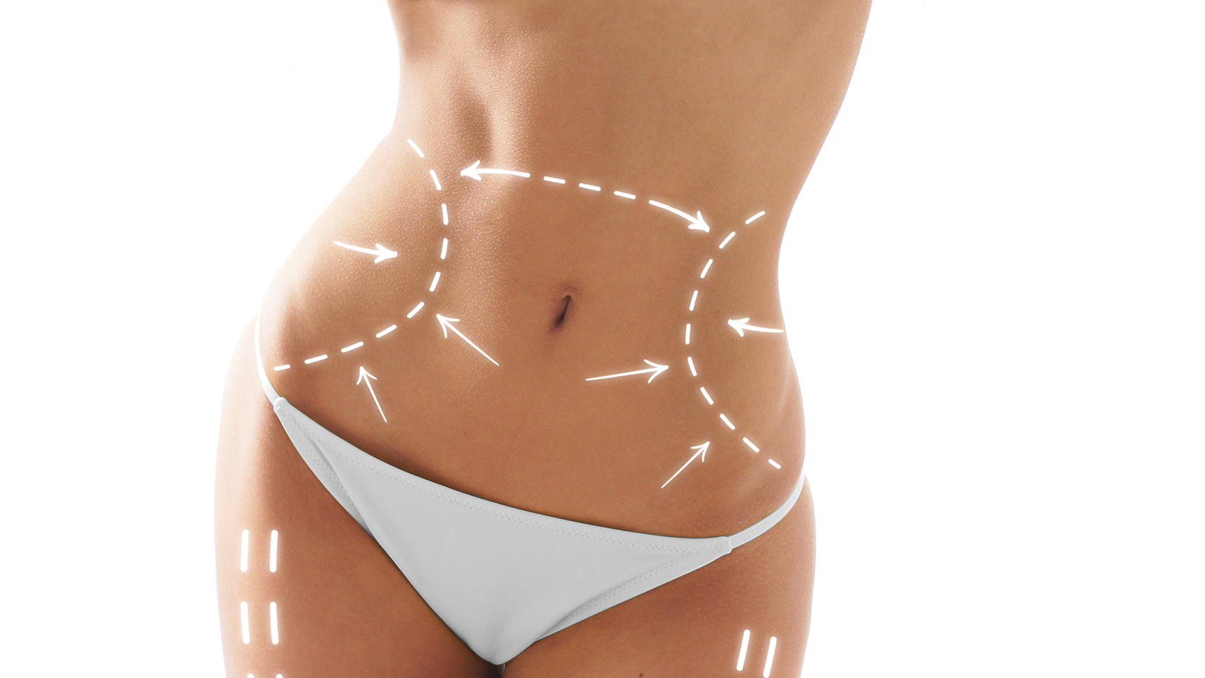 10 Risks and Benefits of Liposuction