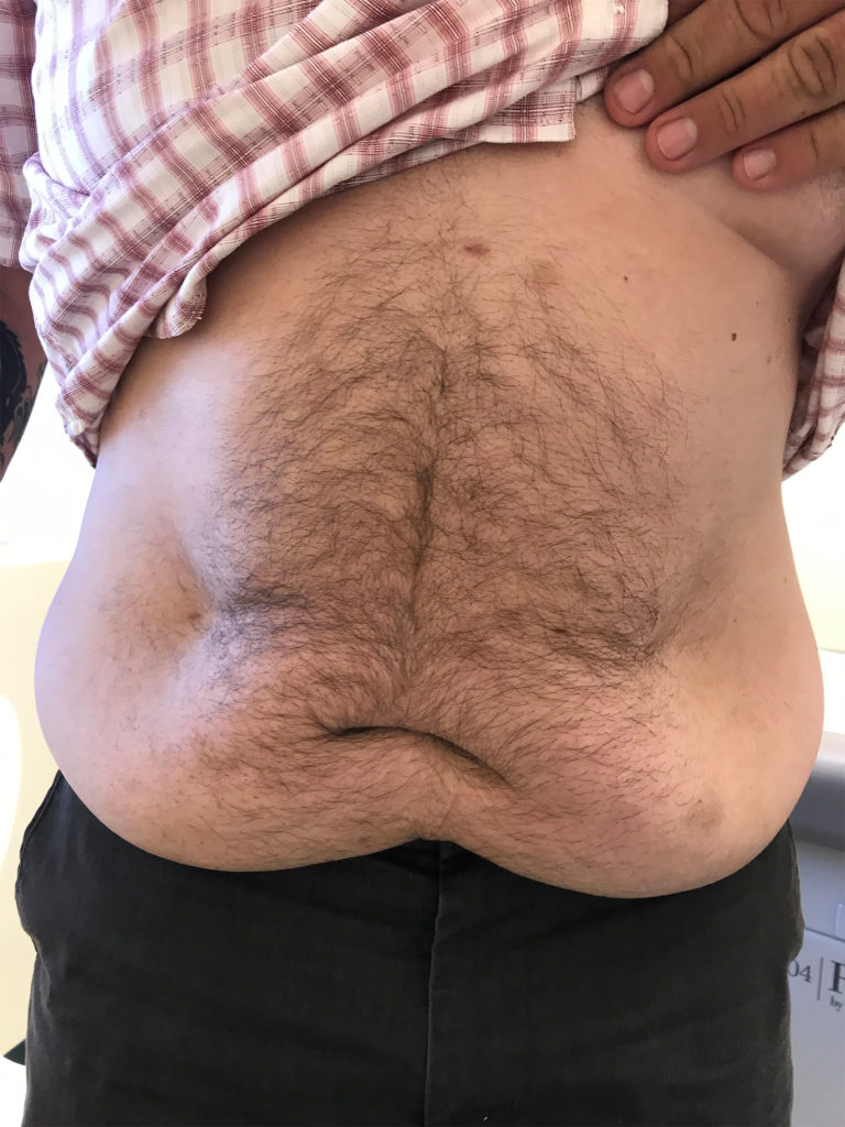 Top 10 Benefits of Getting a Gastric Sleeve