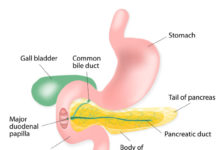 Pancreatectomy Procedure Description