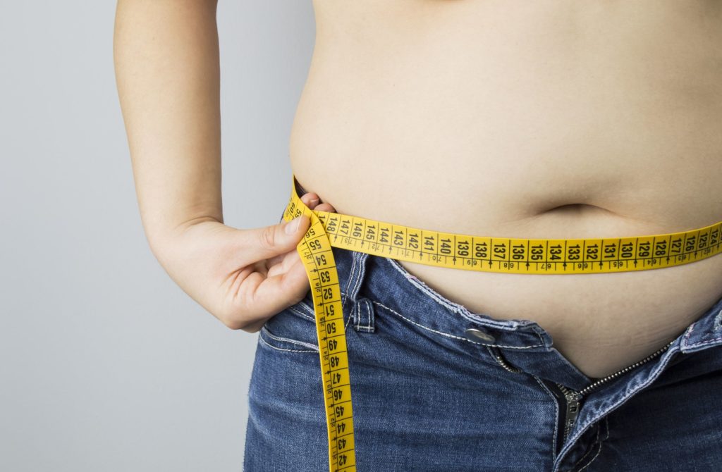 Gastric Plication Procedure Description