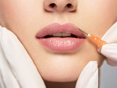 Lip Fillers FAQ