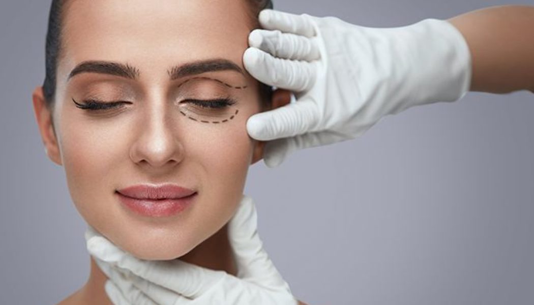 Eyelid Surgery FAQ
