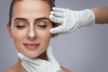 Eyelid Surgery FAQ