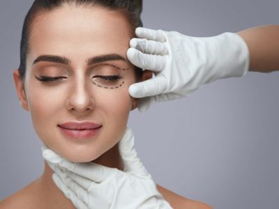 Eyelid Surgery FAQ