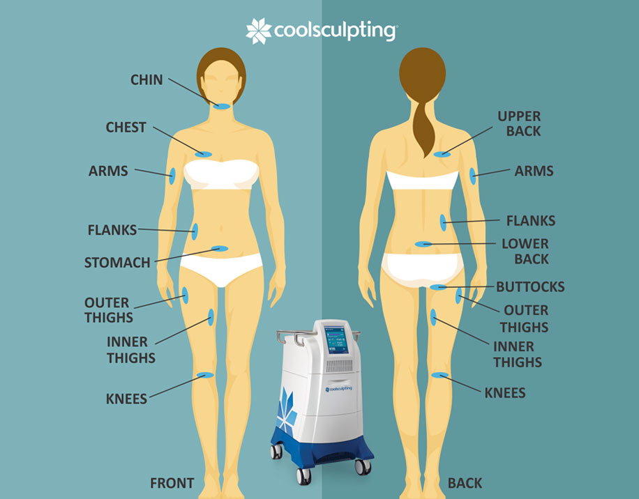 CoolSculpting Before and After by Body Part