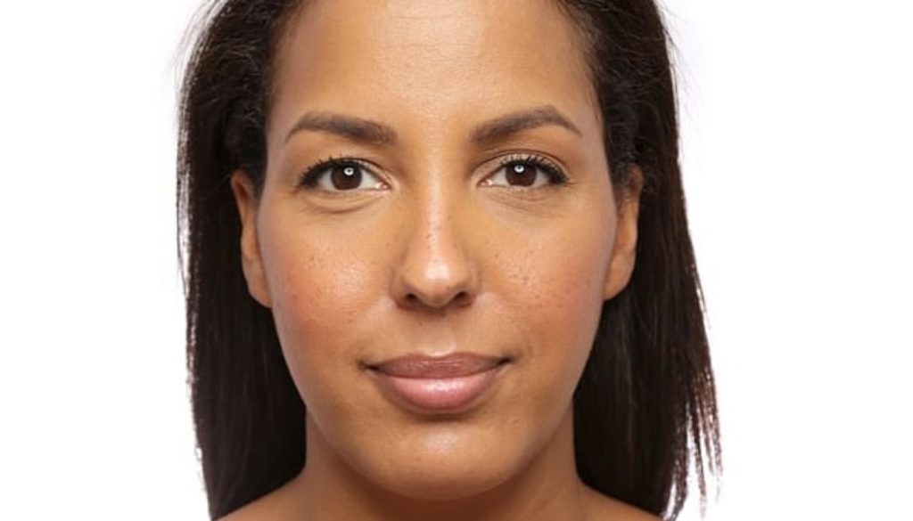 Top 10 Hospitals and Clinics in Bangkok for Hair Line Lowering Procedures