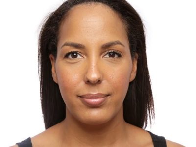 Top 5 Hospitals and Clinics in Istanbul for Hair Line Lowering Procedures