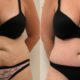 Top 8 reasons to have Tummy Tuck Surgery in Turkey