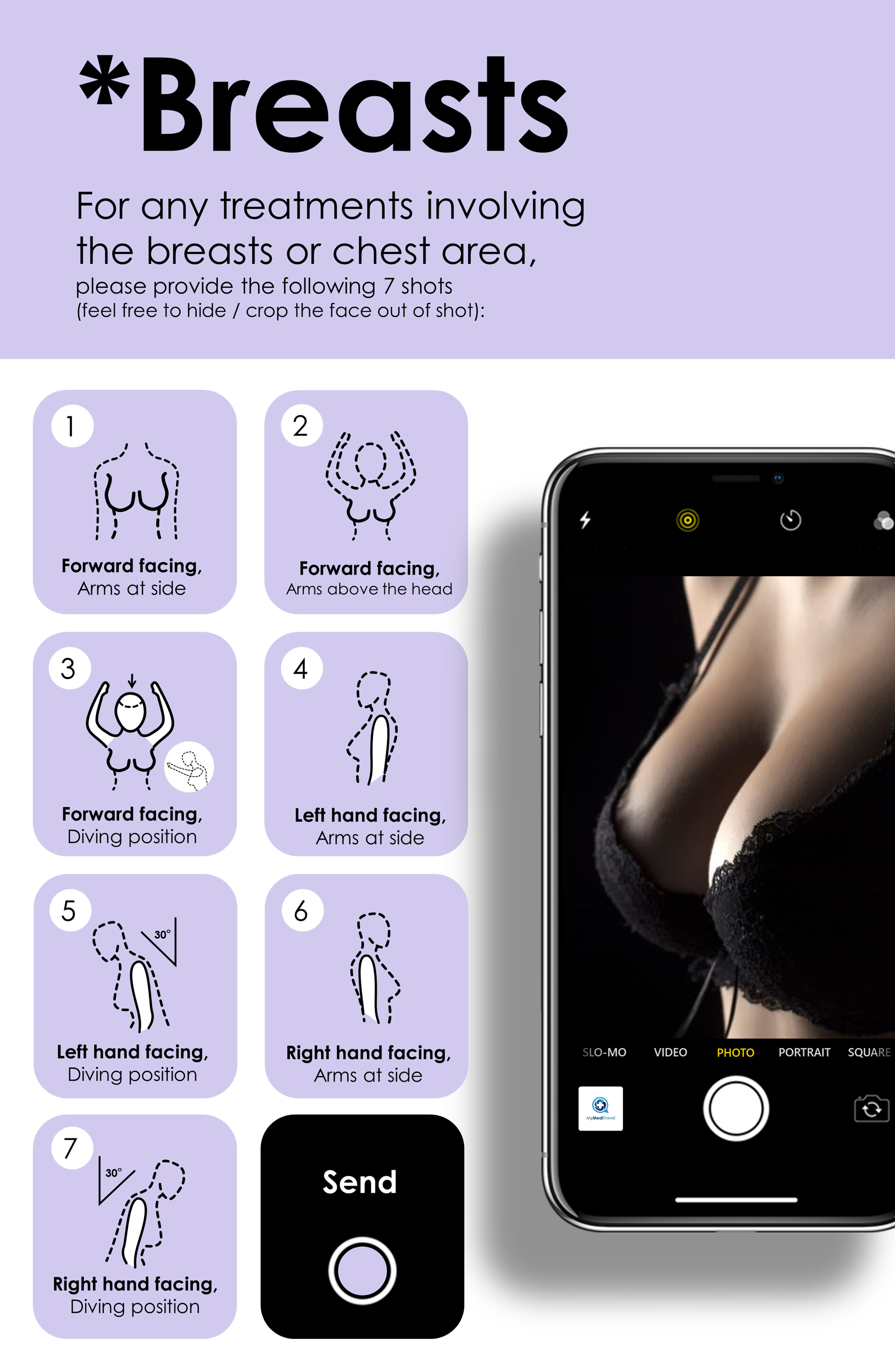 Photo Guide: Breasts