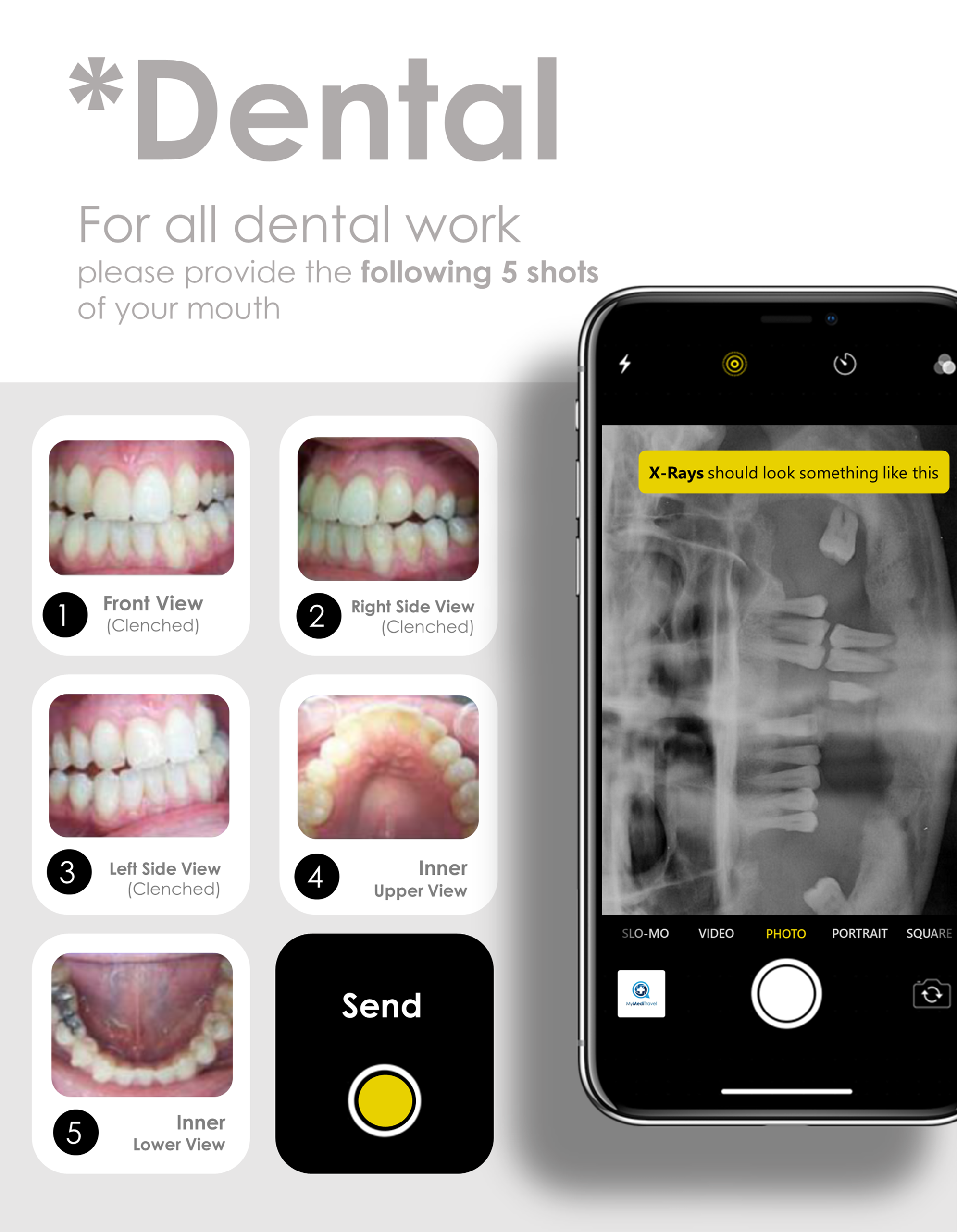 Dental Treatments Photo Guide