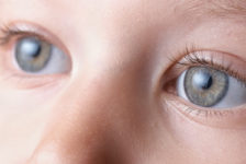 Cataract Surgery the Facts