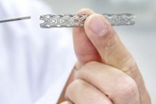 Stent Insertion Procedure Description
