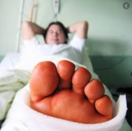 Foot Surgery Procedure Description