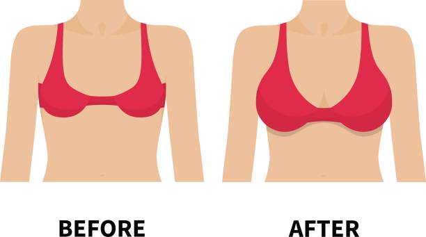 Affordable and High-Quality Breast Implants in Thailand: Your Ultimate Guide