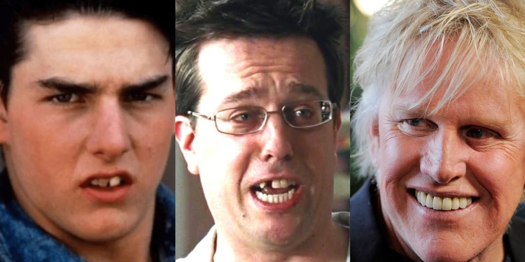 Celebrity Dental Stories: Fascinating Facts and Fails