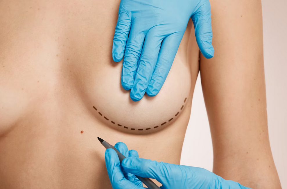 How to choose a plastic surgeon for breast augmentation in Thailand
