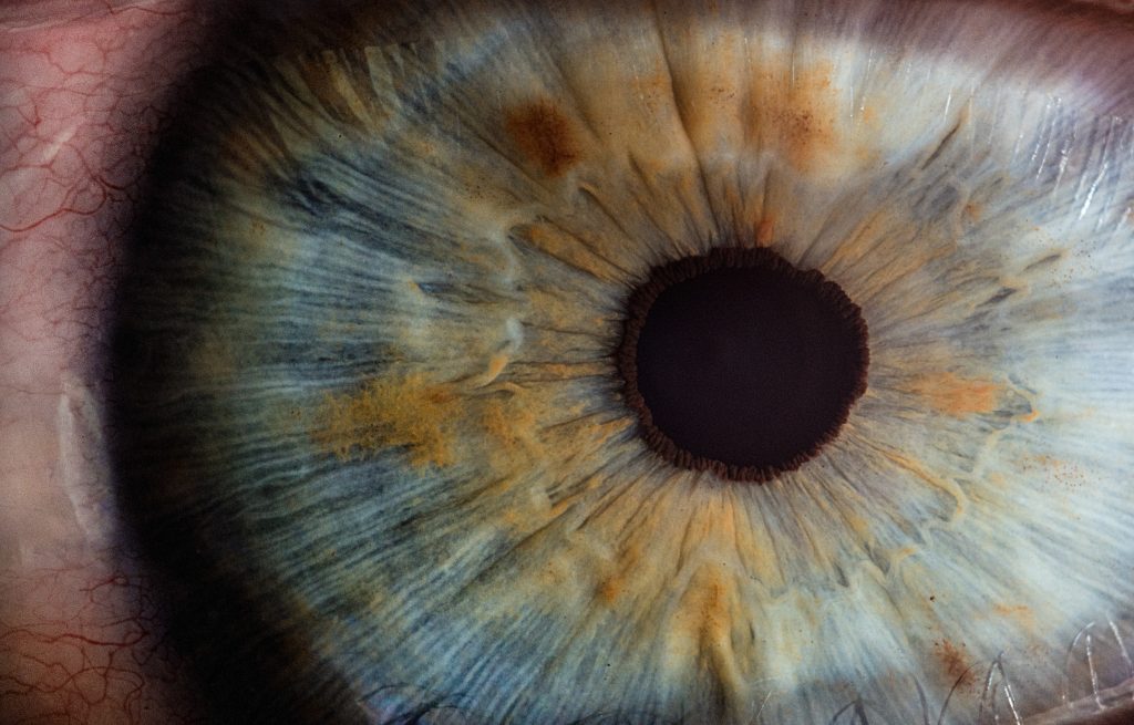 Cataract Surgery: What You Need to Know cataract surgery